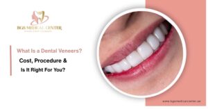 What are Dental veneers? Who is it for?