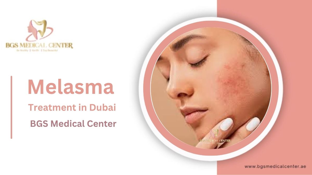 BGS Clinic offers the best Melasma treatment in Dubai’s climate