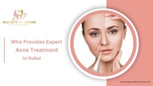 Who Provides Expert Acne Treatment in Dubai?
