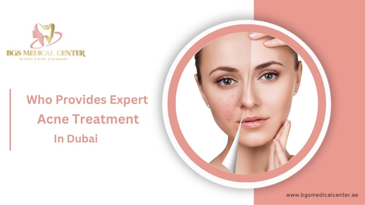 Who Provides Expert Acne Treatment in Dubai?