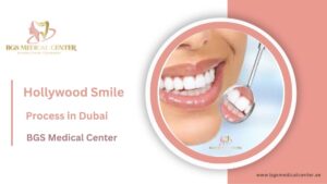 Hollywood smile process Dubai consultation to final result