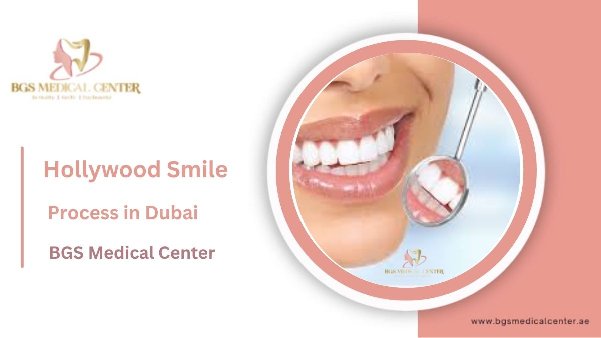 Hollywood Smile Process Dubai: From Consultation to Final Result (Timeline)