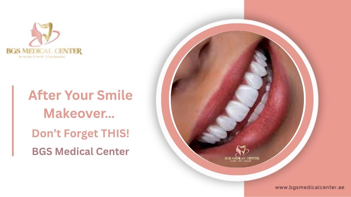 Maintaining Your Hollywood Smile in Dubai: Care Tips & Costs After Treatment